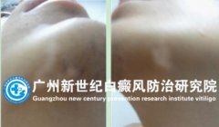 ¬���� 22�� ���װ�2������ 