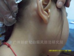 ��С���� 5�� �Ҷ�����ǰװ߰���� 