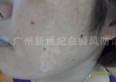 ��Ůʿ 46�� ���հװ�1���� 