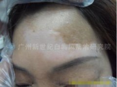 ��Ůʿ 35�� ��ͷ�װ� 30���� 