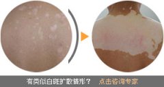 �����֢״�仯Ԥʾ��ʲô�� 