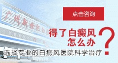 ������ʳע����������Щ? 