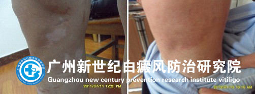 ��ͬѧ 14�� ��С�Ȱװ�7����