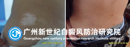 ��ͬѧ 14�� ��С�Ȱװ�7����