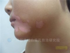 ��С���� 9�� ���ڽ�Ƭ״�װ�4���� 