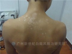 �������� ������һ��������δ�� 