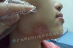 ���Ƥ��Σ��������װ�Ϊ�� 